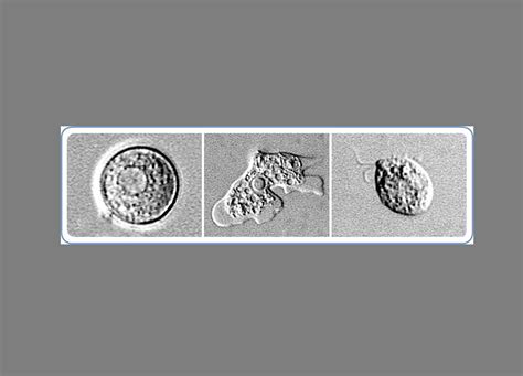 Rare brain-eating amoeba was cause of Arkansas child's death